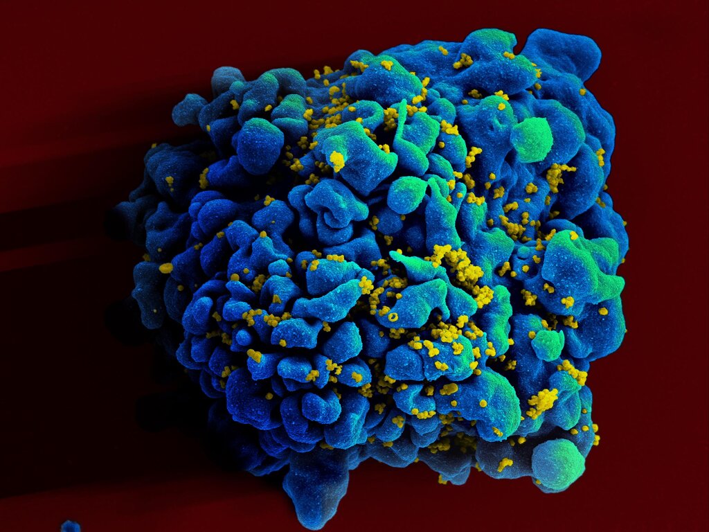 How ‘elite controllers’ tame HIV without drugs