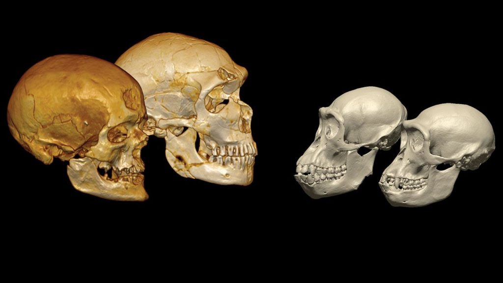 The factors resulting in severity of COVID 19