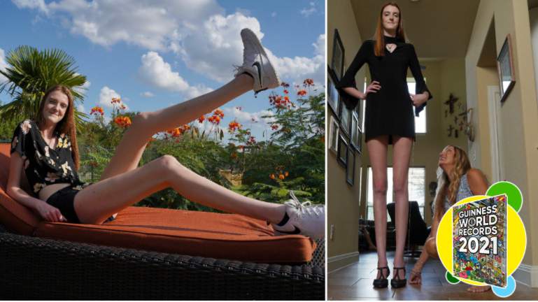 Video: Texas teen-Guinness world’s longest legs