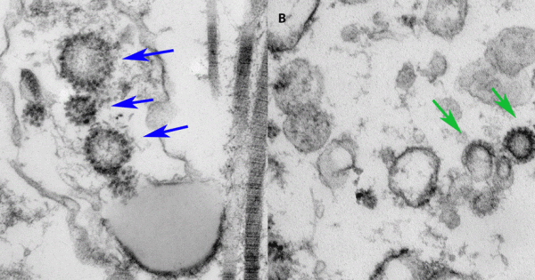 COVID-19 can invade testicles, University of Miami researchers find, learn more, News Without Politics is the most unbiased news source