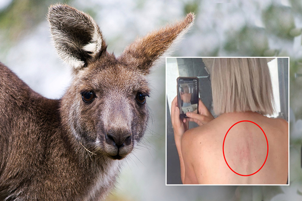 Why a crazed kangaroo attacked woman jogger-learn more from NWP unbiased about the woman  in Australia, no politics