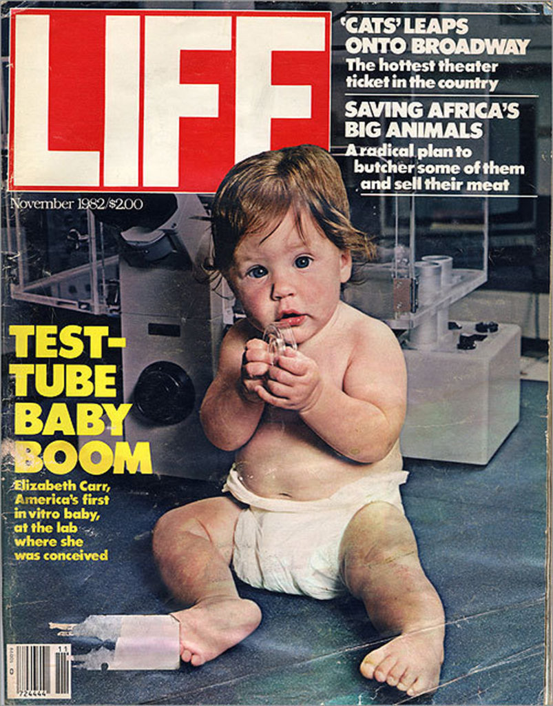 First American "test-tube baby" is born-this day in history,follow News Without Politics to learn more, Elizabeth Carr, infertility, non political news