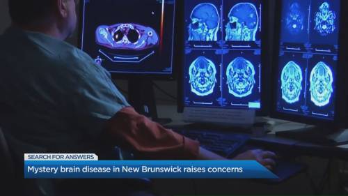 Mysterious brain disease in Canada
