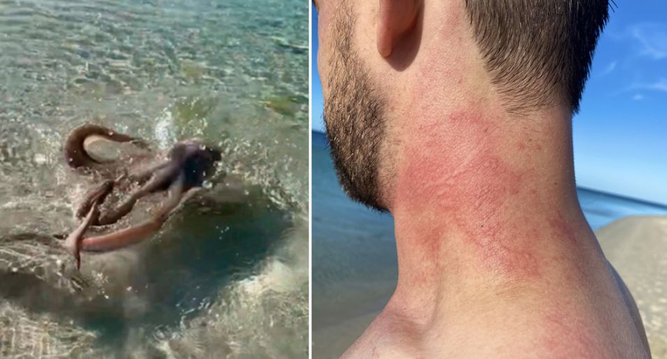 Octopus attacks man while swimming