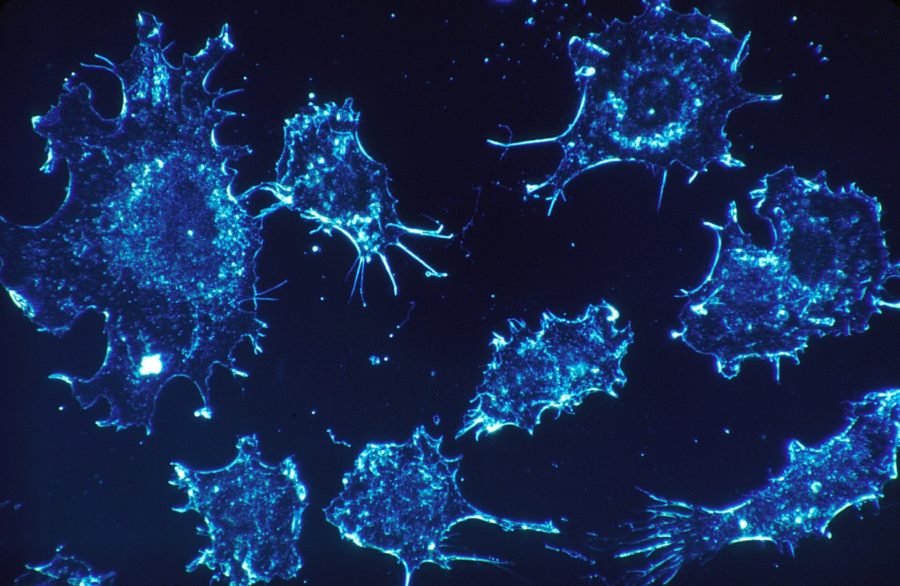 New research findings about most cancer cells