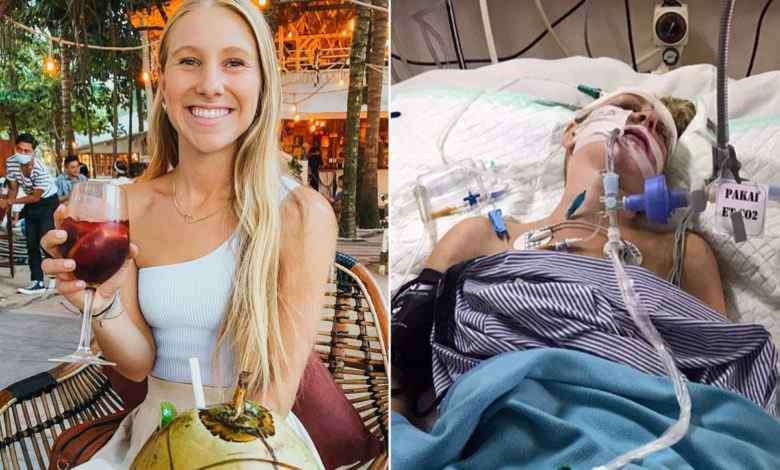 Travel blogger in coma after Bali scooter crash