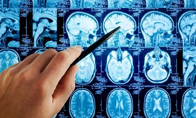 unbiased news dementia brain scan non-political news 