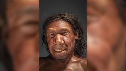Lumpy tumor shown on facial reconstruction of Neanderthal
