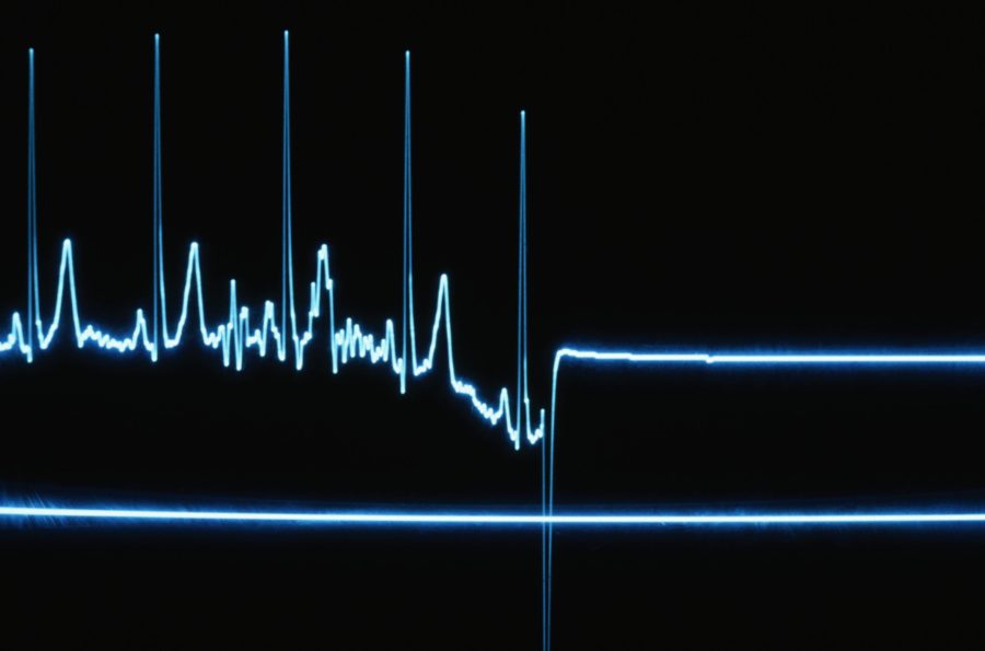 The brain waves of a dying patient recorded- new findings