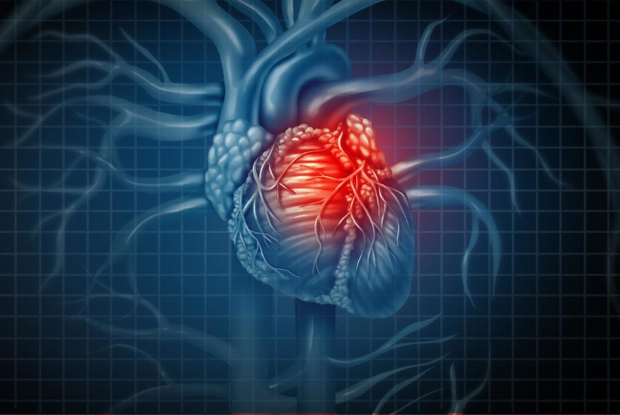 How likely is a heart attack survivor to develop Parkinson’s?